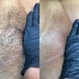 Brazilian Wax with vajacial