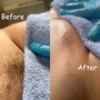 Brazilian Wax