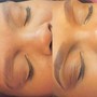 Eyelash Extension Removal