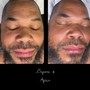 Customized Facial