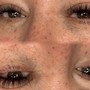 Eyelash Extension Removal