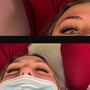 Eyelash Extension Removal