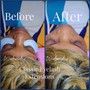 Eyelash Extension Removal