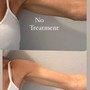 Underarm Wax