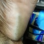 Foot Paraffin treatment