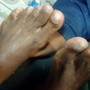 Foot Paraffin treatment