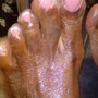 Foot Paraffin treatment