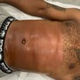 Belly Facial