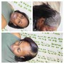 Scalp Treatment