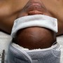 Men Beard Revival Treatment