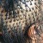 Scalp Treatment