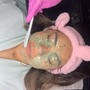 Chemical peel