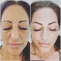 Eyebrow: Microblading