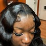 Scalp Treatment