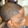 Hairline restoration