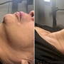 Underarm Wax