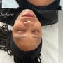 Back Facial