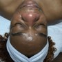 Dermaplaning Facial