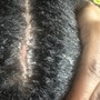 Scalp Treatment