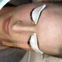 Dermaplaning facial