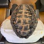 Scalp Treatment