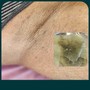 Underarm Wax