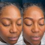 Eyebrow: Microblading