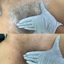 Underarm Wax