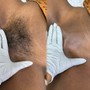 Routine Brazilian Wax