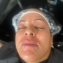 Scalp Treatment