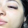 Eyelash Extension Removal