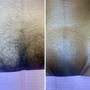 Brazilian Wax