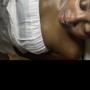 Oxygen Infused Facial