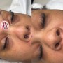 Eyelash Extension Removal