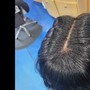 Scalp Treatment