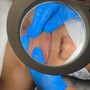 Diamond Drip Facial