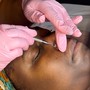 Treatment Facial