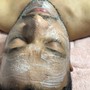 Treatment Facial