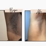 Men’s Brazilian Wax