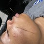 Dermaplaning Facial