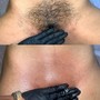 Mens Brazilian Wax and Brojacial