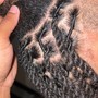 Scalp-Treatment