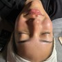 Facial