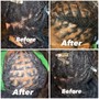 Scalp-Treatment