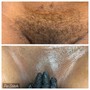 Brazilian Wax