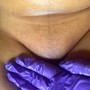 Microdermabrasion Facial