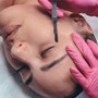 Dermaplaning