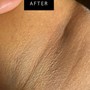 Underarm Wax