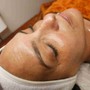 Diamond Dermabrasion Facial