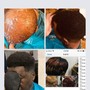 Scalp Treatment